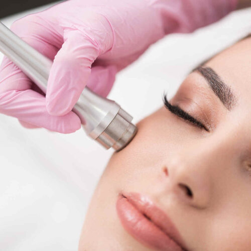 Microdermabrasion